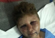 Un poliţist a bătut până la desfigurare o femeie. „Mi-a spus că ies doar cu picioarele înainte”