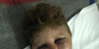 Un poliţist a bătut până la desfigurare o femeie. „Mi-a spus că ies doar cu picioarele înainte”